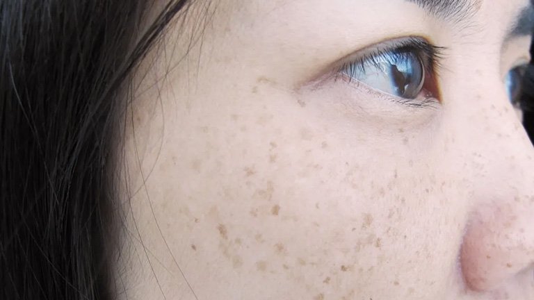 cara mengatasi flek hitam di wajah dengan Garnier Vitamin C Dry Touch Cream, mencerahkan kulit dan flek hitam hingga 47%