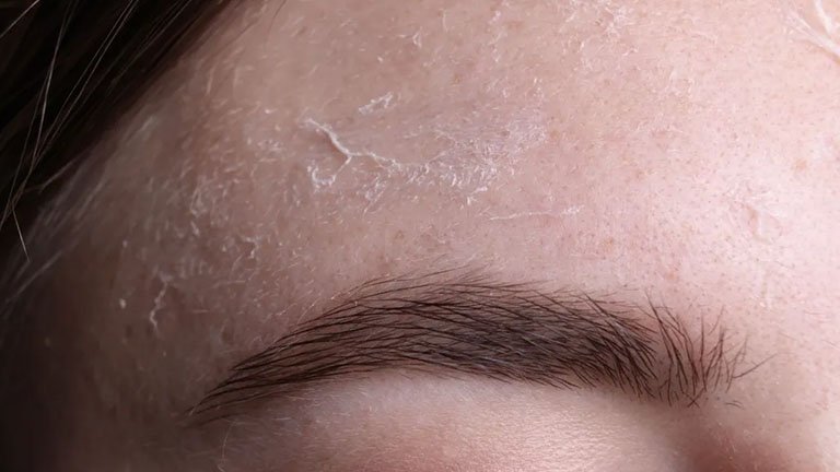 moisturizer untuk kulit kering wajah yang mengelupas dari Garnier