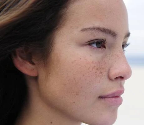 Cara Menghilangkan Hiperpigmentasi di Wajah dengan produk dari Garnier