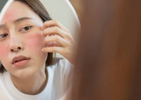 Cara Meratakan Warna Kulit Wajah yang Terlanjur Belang