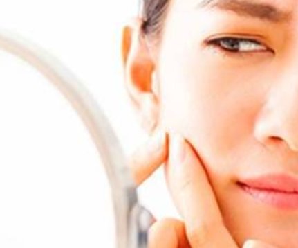 Cara Merawat Kulit Wajah yang Berminyak dan Berjerawat