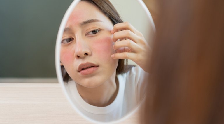 Kulit Dehidrasi Ini Ciri, Penyebab, dan Cara Mengatasinya