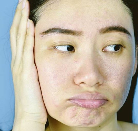 Pembersih Wajah yang Bagus sesuai Jenis Kulit