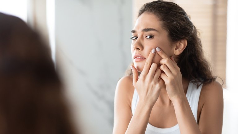 Selain Makanan, ini penyebab jerawat