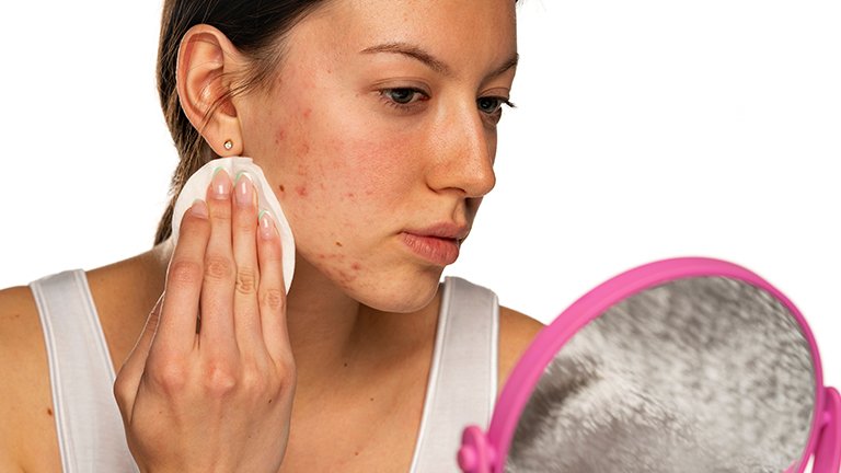 Kandungan Micellar Water untuk Menghilangkan Bekas Jerawat