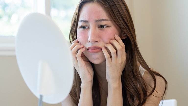 5 Cara Mengatasi Kulit Wajah yang Kering dan Gatal dengan Aman