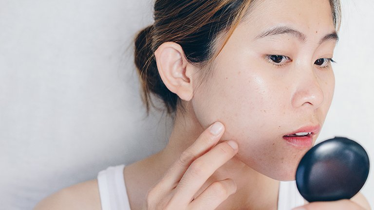 Intip Cara Menghilangkan Flek Hitam di Wajah yang Efektif