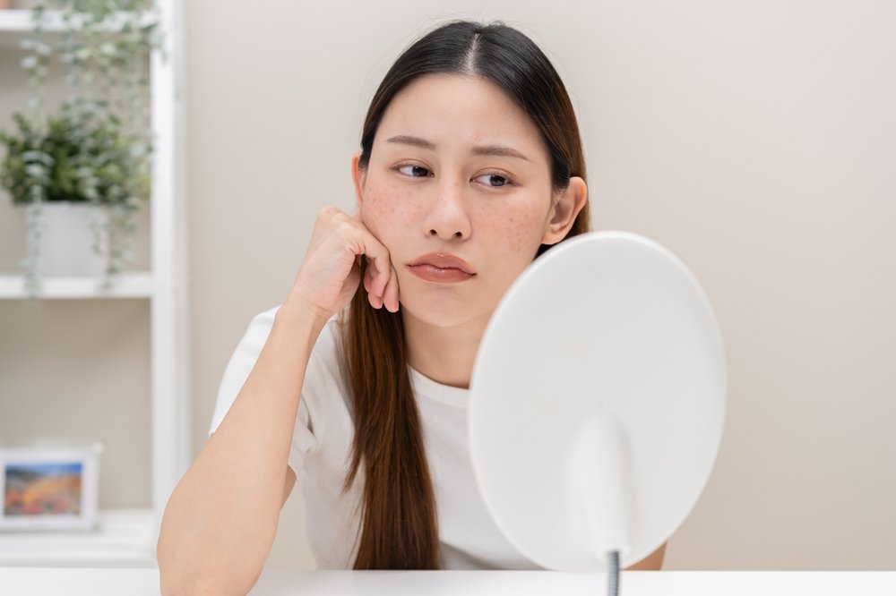 Apa Itu Flek Hitam dan Penyebabnya Cek di Sini!