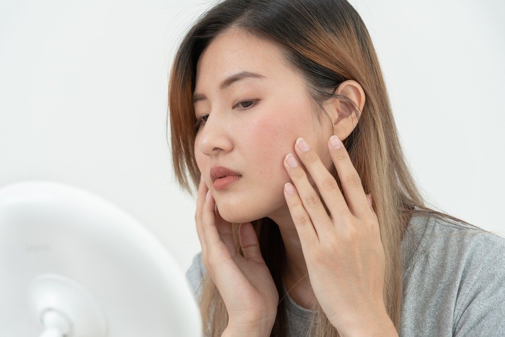 Kulit Kering Karena Cuaca Panas? Cek Tips Mengatasinya di Sini!