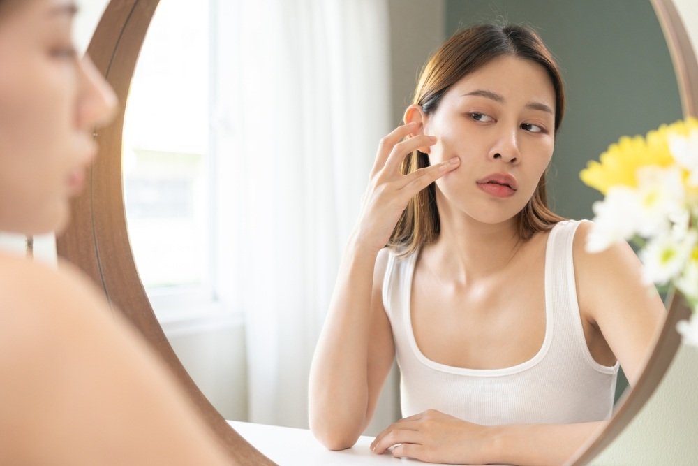 Apa Itu Pigmentasi dan Bagaimana Cara Mengatasinya