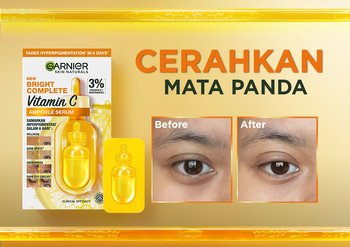 HyperpigmentationRating_2