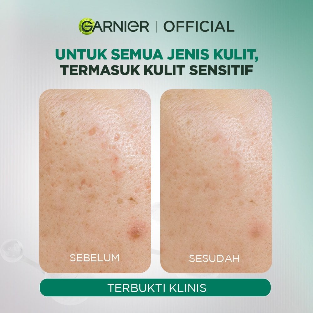 Garnier Tri Acid Renew Peeling Serum